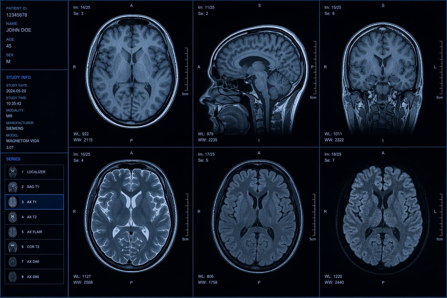 Florida medical malpractice — brain imaging study under clinical review